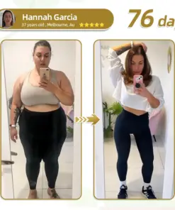 𝐇𝐇𝐕𝐁® 𝐌𝐨𝐫𝐢𝐧𝐠𝐚+𝐍𝐚𝐧𝐨 𝐌𝐢𝐜𝐫𝐨𝐧𝐞𝐞𝐝𝐥𝐞 𝐏𝐚𝐭𝐜𝐡 𝐰𝐢𝐭𝐡 𝐒𝐌𝐆𝐓-𝐆𝐋𝐏-𝟏 & 𝐌𝐚𝐭𝐫𝐢𝐱𝐲𝐥 𝟑𝟎𝟎𝟎