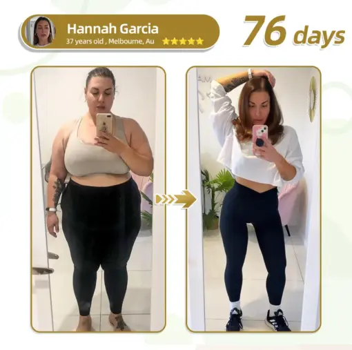 𝐇𝐇𝐕𝐁® 𝐌𝐨𝐫𝐢𝐧𝐠𝐚+𝐍𝐚𝐧𝐨 𝐌𝐢𝐜𝐫𝐨𝐧𝐞𝐞𝐝𝐥𝐞 𝐏𝐚𝐭𝐜𝐡 𝐰𝐢𝐭𝐡 𝐒𝐌𝐆𝐓-𝐆𝐋𝐏-𝟏 & 𝐌𝐚𝐭𝐫𝐢𝐱𝐲𝐥 𝟑𝟎𝟎𝟎