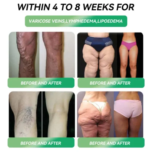 𝐇𝐇𝐕𝐁® 𝐆𝐋𝐏-𝟏 𝐒𝐥𝐢𝐦𝐦𝐢𝐧𝐠 & 𝐇𝐞𝐚𝐥𝐭𝐡 𝐔𝐥𝐭𝐫𝐚 𝐂𝐨𝐧𝐜𝐞𝐧𝐭𝐫𝐚𝐭𝐞𝐝 𝐄𝐬𝐬𝐞𝐧𝐜𝐞 𝐋𝐢𝐪𝐮𝐢𝐝 𝐁𝐞𝐚𝐝𝐬
